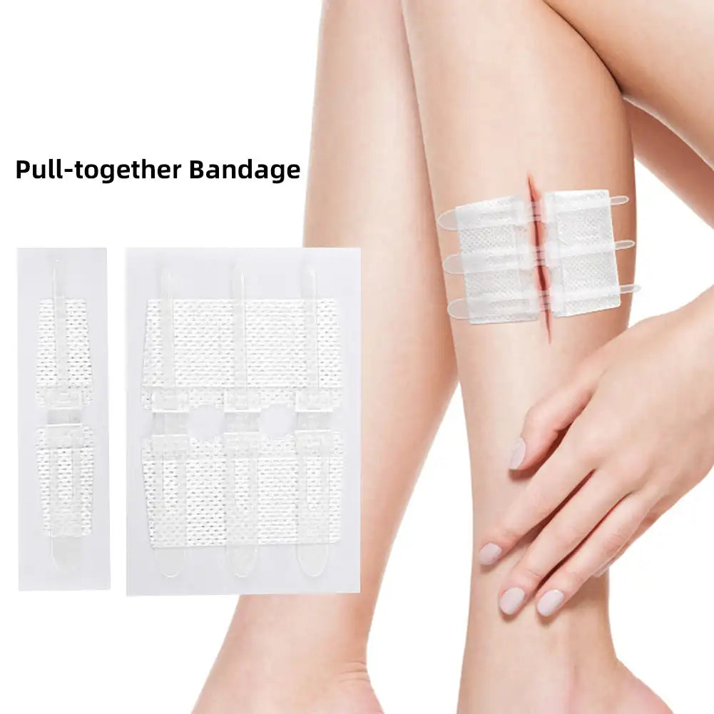 Wound Dressing Closure Strips