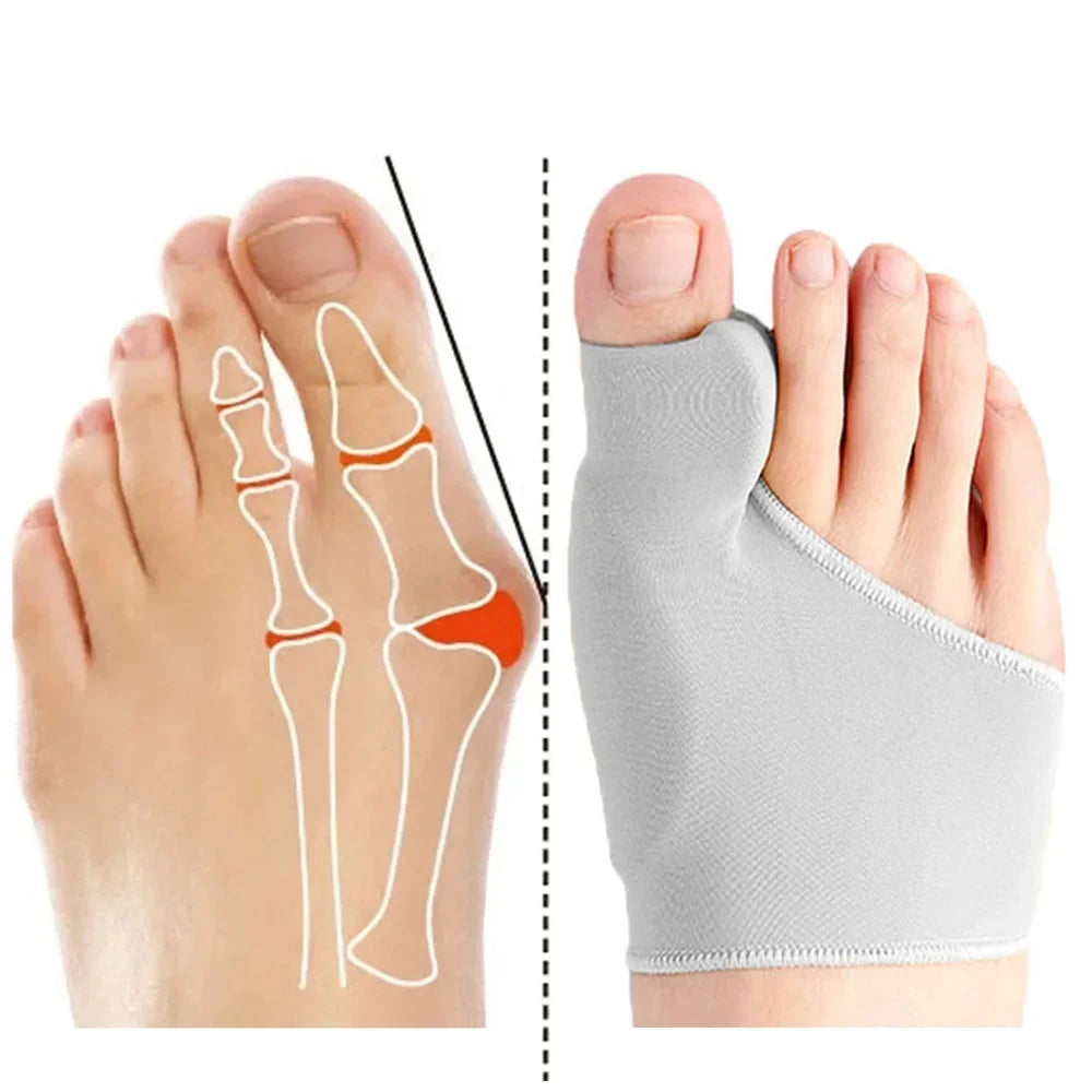 Hallux Valgus Bunion Corrector