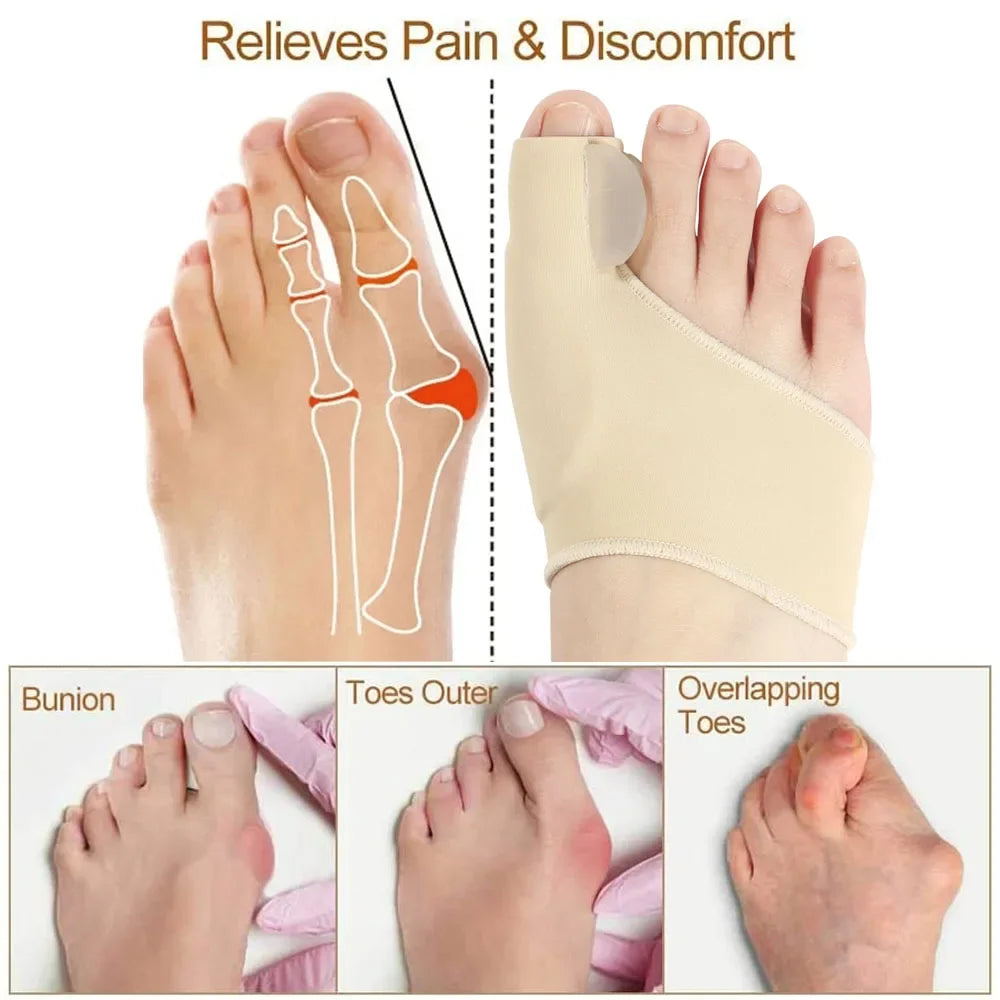 Hallux Valgus Bunion Corrector