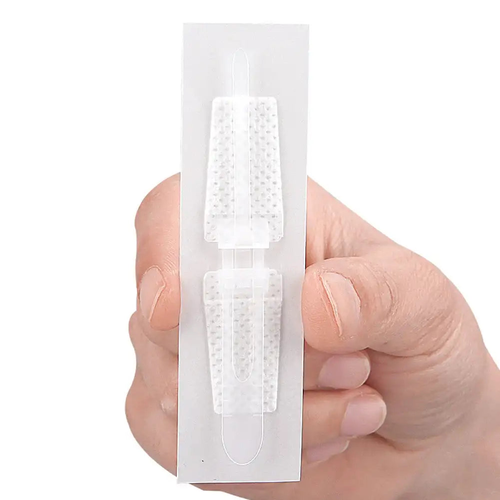 Wound Dressing Closure Strips