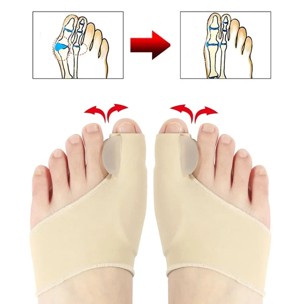 Hallux Valgus Bunion Corrector