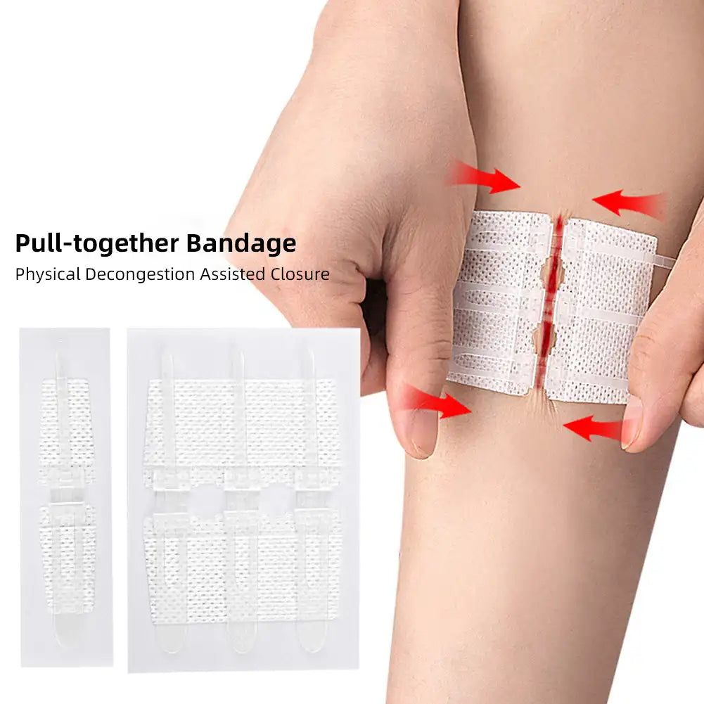 Wound Dressing Closure Strips