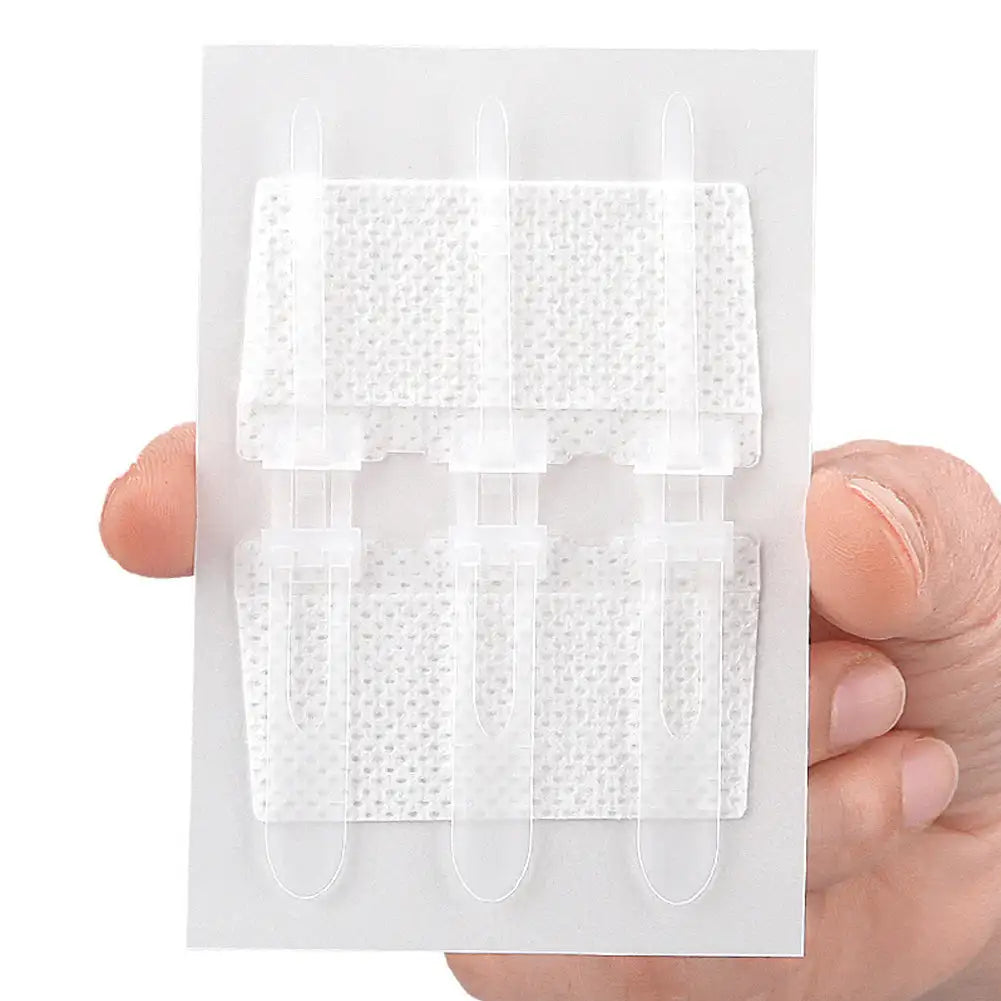 Wound Dressing Closure Strips